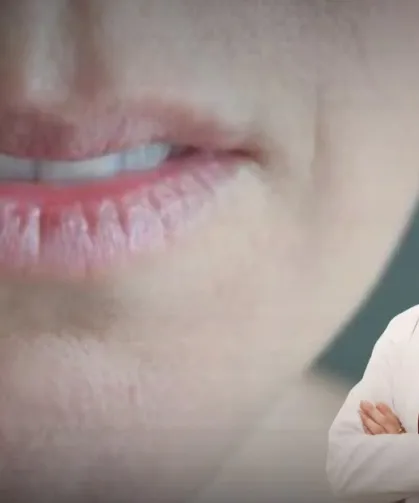 Ağız kuruluğu uyarısı! Sürekli su içme ihtiyacı başka hastalıkların habercisi olabilir